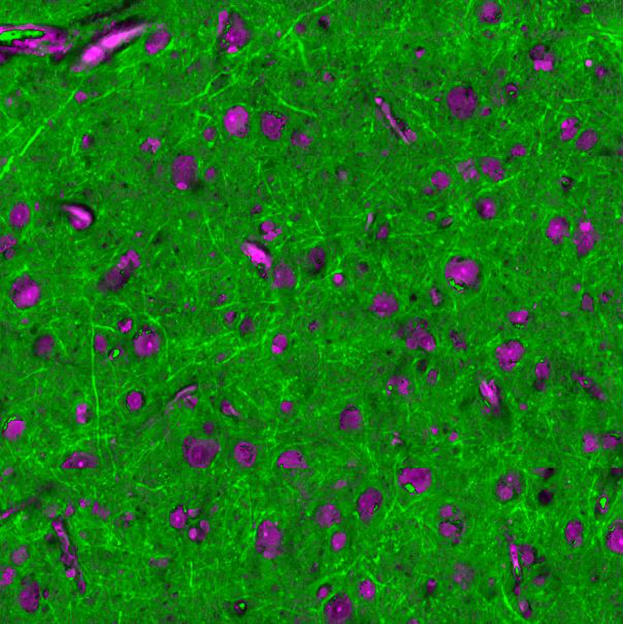 Explore hidden structures within cells and tissues