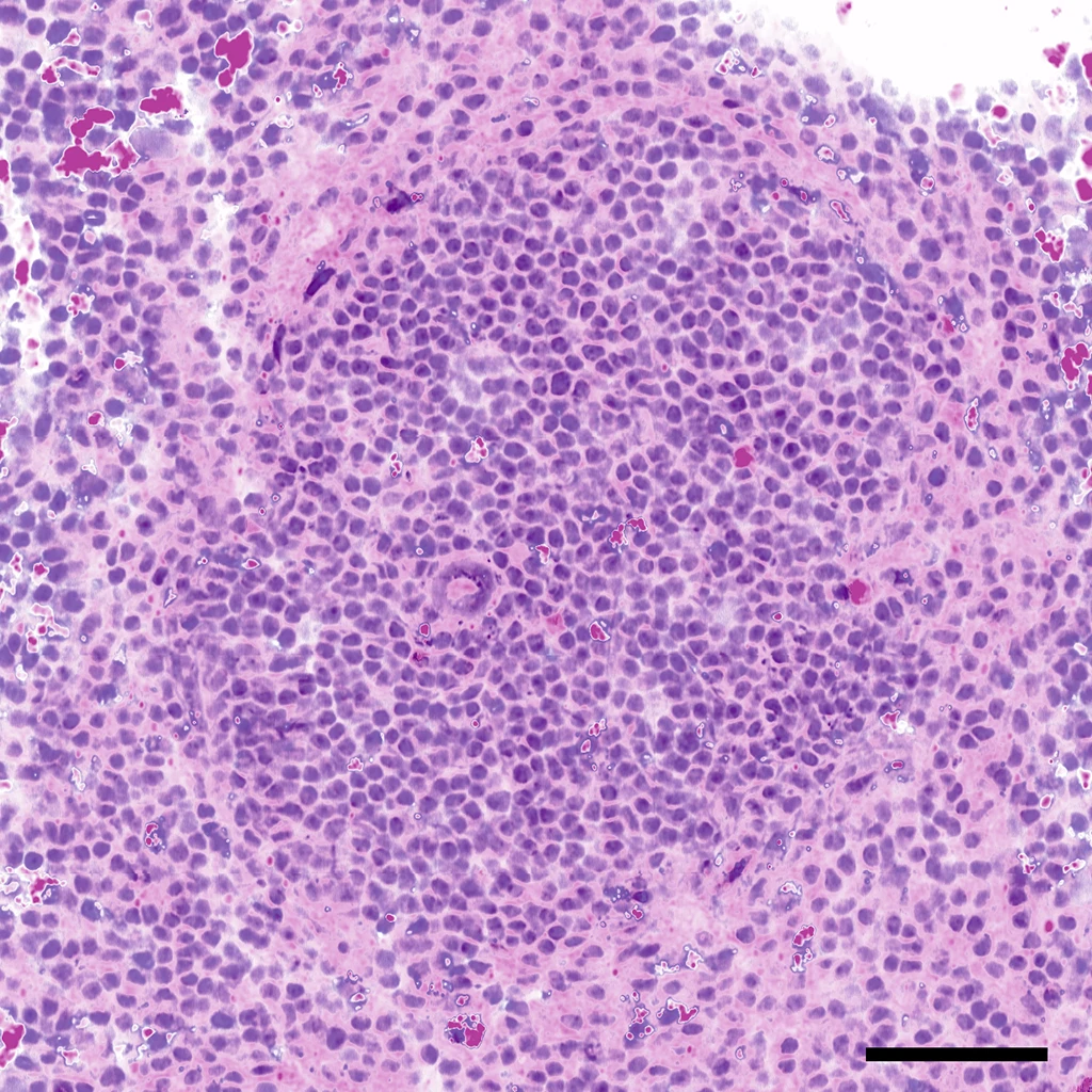 Virtual H&E image of spleen tissue